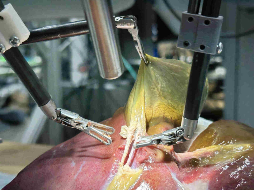 robot chirurgien IA