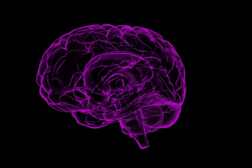 carte cerebrale amputation