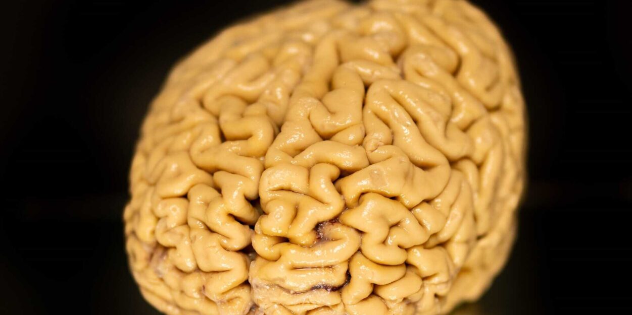 declin cognitif vieillissement superAger