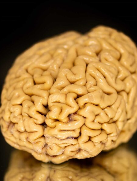 declin cognitif vieillissement superAger