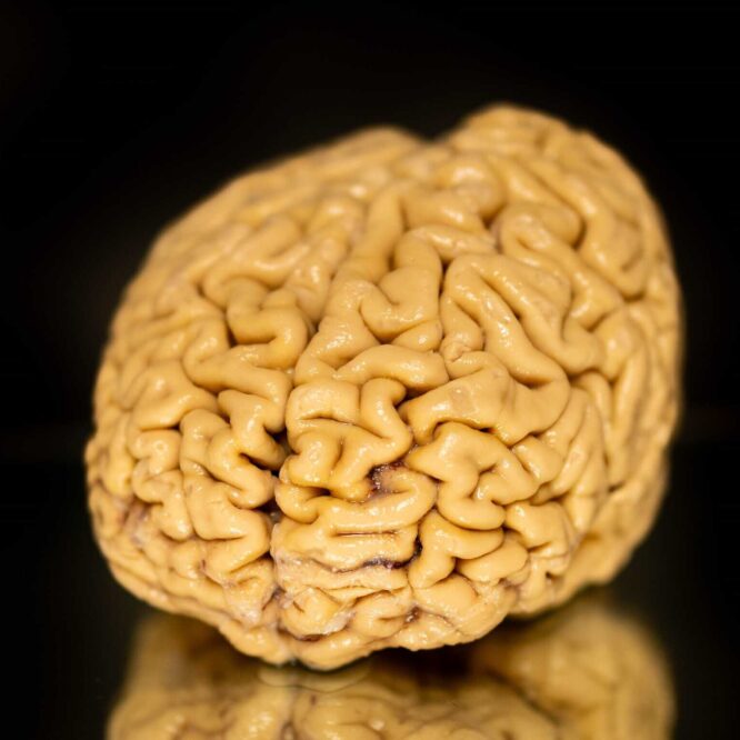 declin cognitif vieillissement superAger
