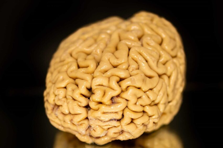 declin cognitif vieillissement superAger