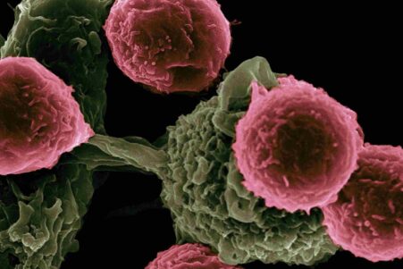 age-avance-cancer-couv