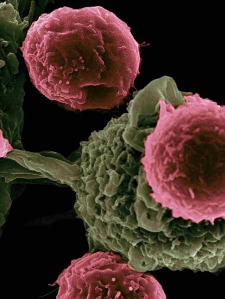 age-avance-cancer-couv