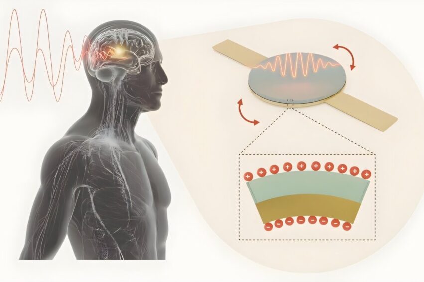 antenne-injectable-implants-couv