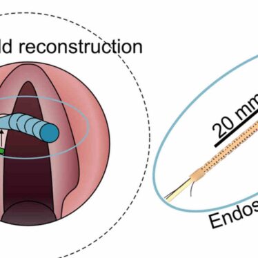bio-imprimante-3d-cordes-vocales-couv