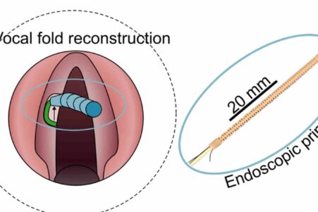 bio-imprimante-3d-cordes-vocales-couv
