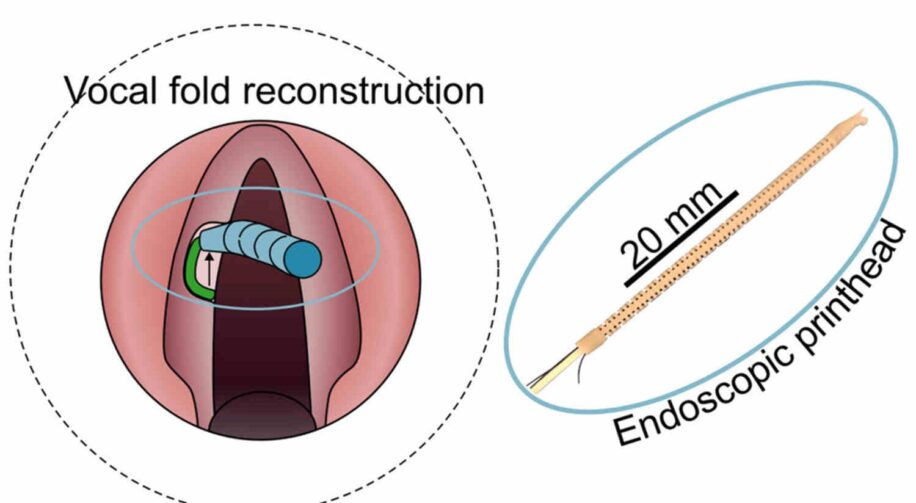 bio-imprimante-3d-cordes-vocales-couv