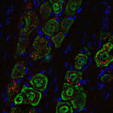nanoparticules-gouttes-nasales-glioblastome-couv