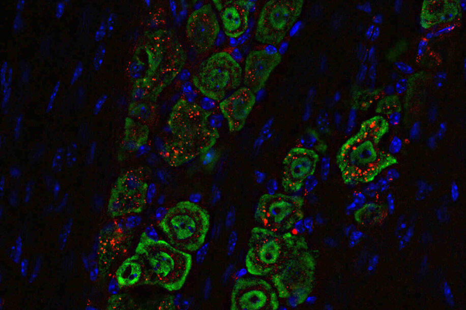 nanoparticules-gouttes-nasales-glioblastome-couv