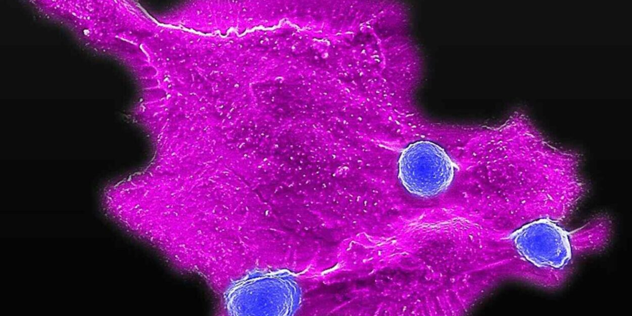 CAR-T-cancer-sein-couv