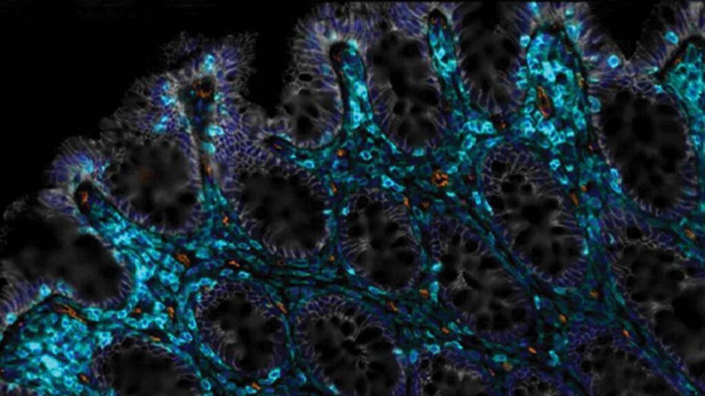 epithelium-senescence