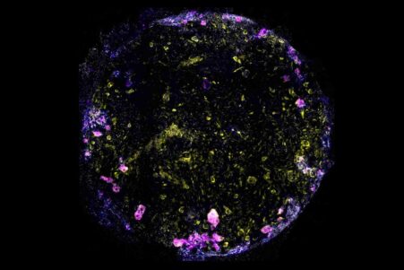 poumon-sur-puce-humain-couv