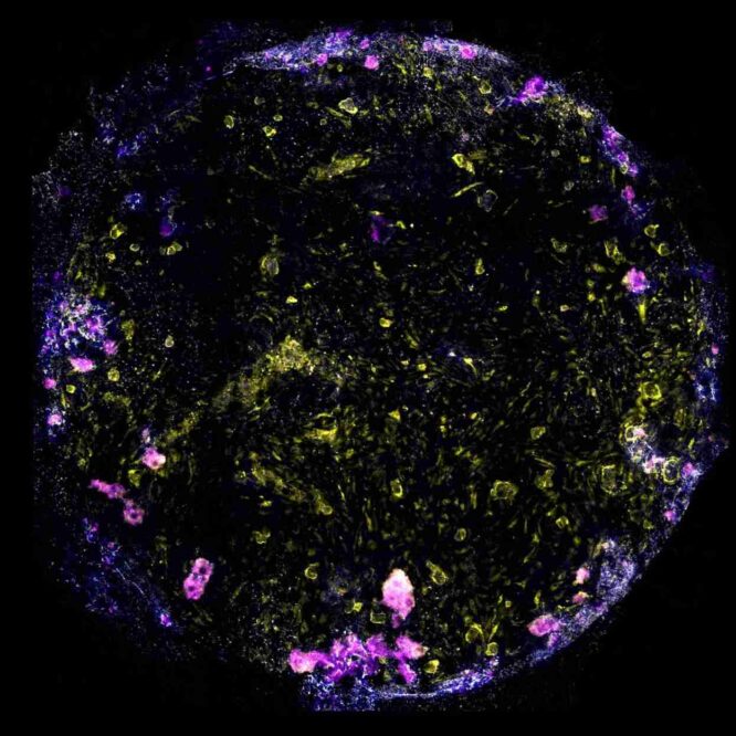 poumon-sur-puce-humain-couv