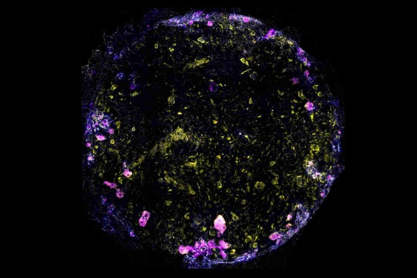 poumon-sur-puce-humain-couv