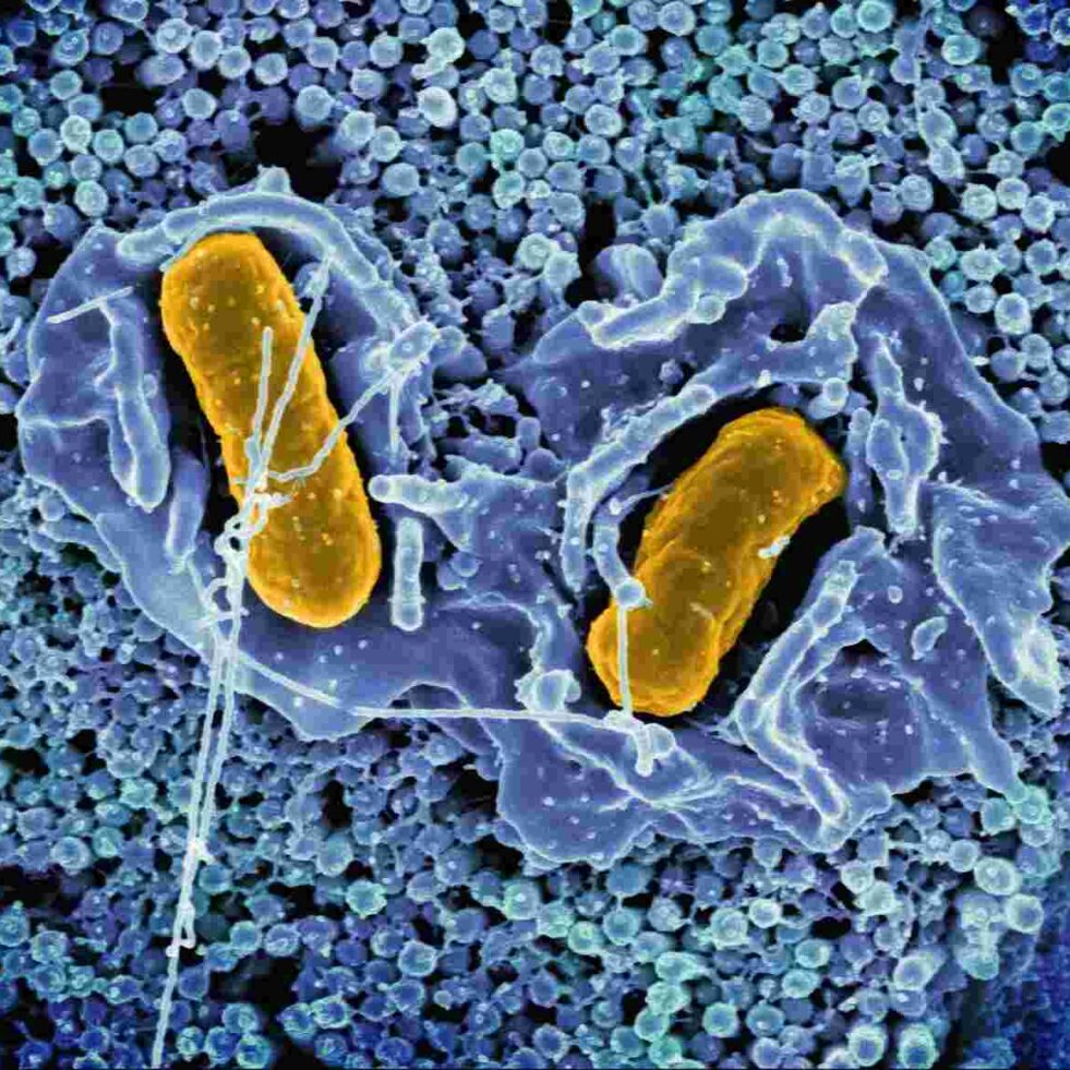 bacteries-resistantes-antibiotiques-modernes-couv