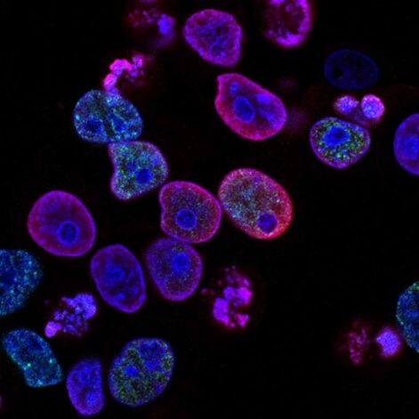 immunotherapie-cancer-heure-couv