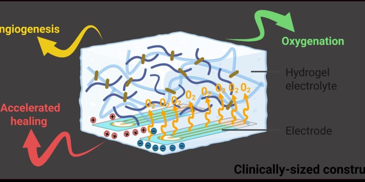 mini-usine-oxygene-plaies-guerrissent-pas-couv