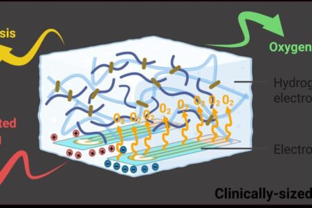 mini-usine-oxygene-plaies-guerrissent-pas-couv