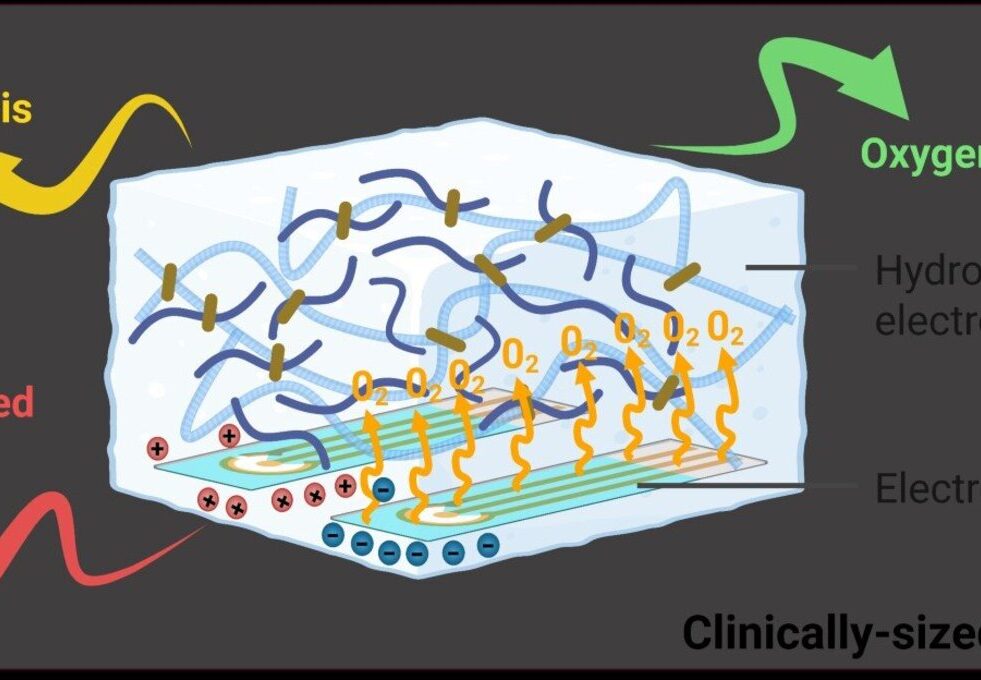 mini-usine-oxygene-plaies-guerrissent-pas-couv