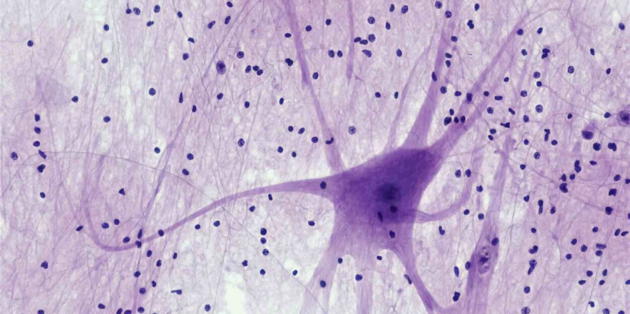 proteine-vieillissement-cerebral-couv